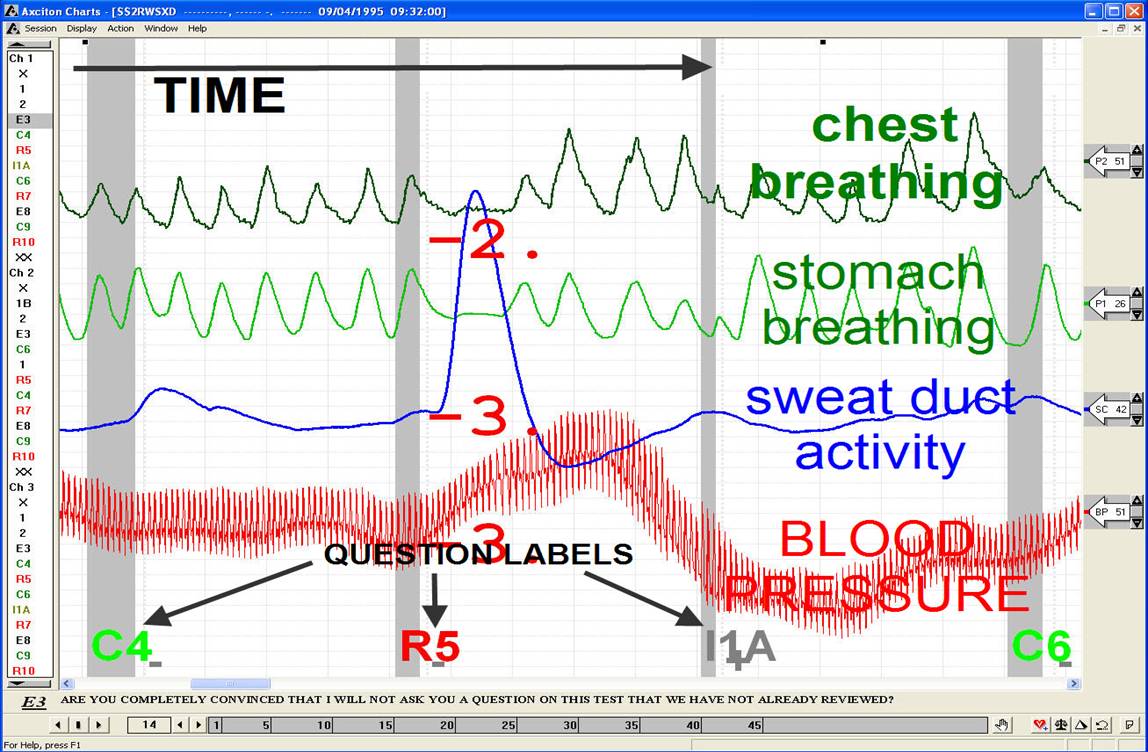 Polygraph Chart Analysis